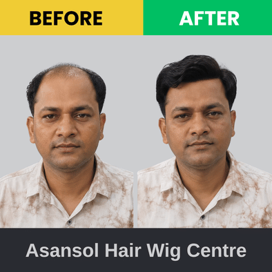 Before & After (1)