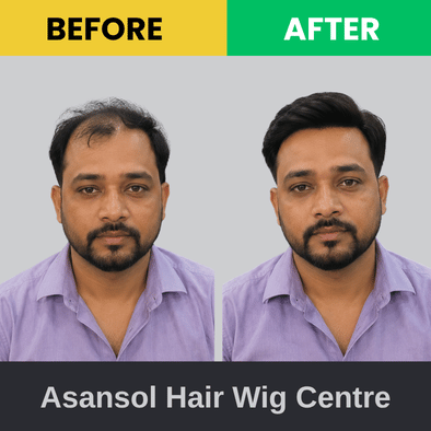 Before & After (2)