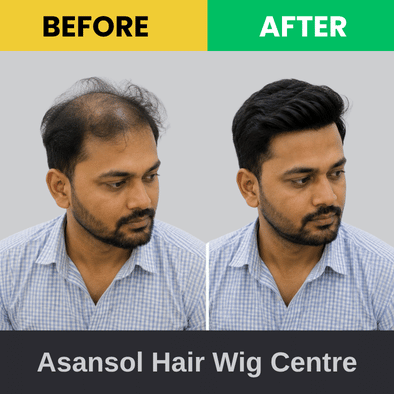 Before & After