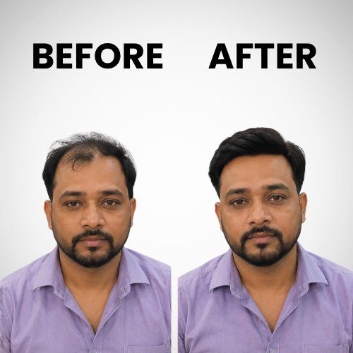 hair wig Asansol