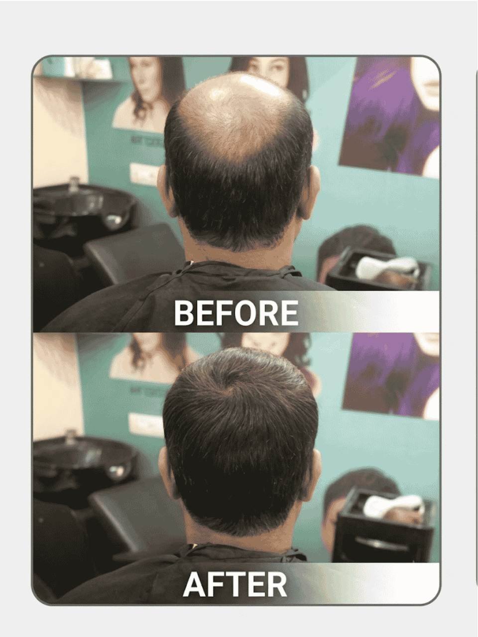 asansol hair wig before after (2)