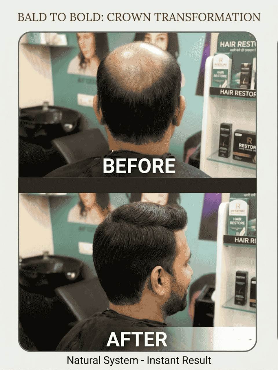 asansol hair wig before after (3)