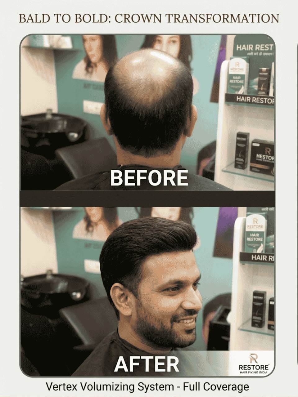 asansol hair wig before after (4)