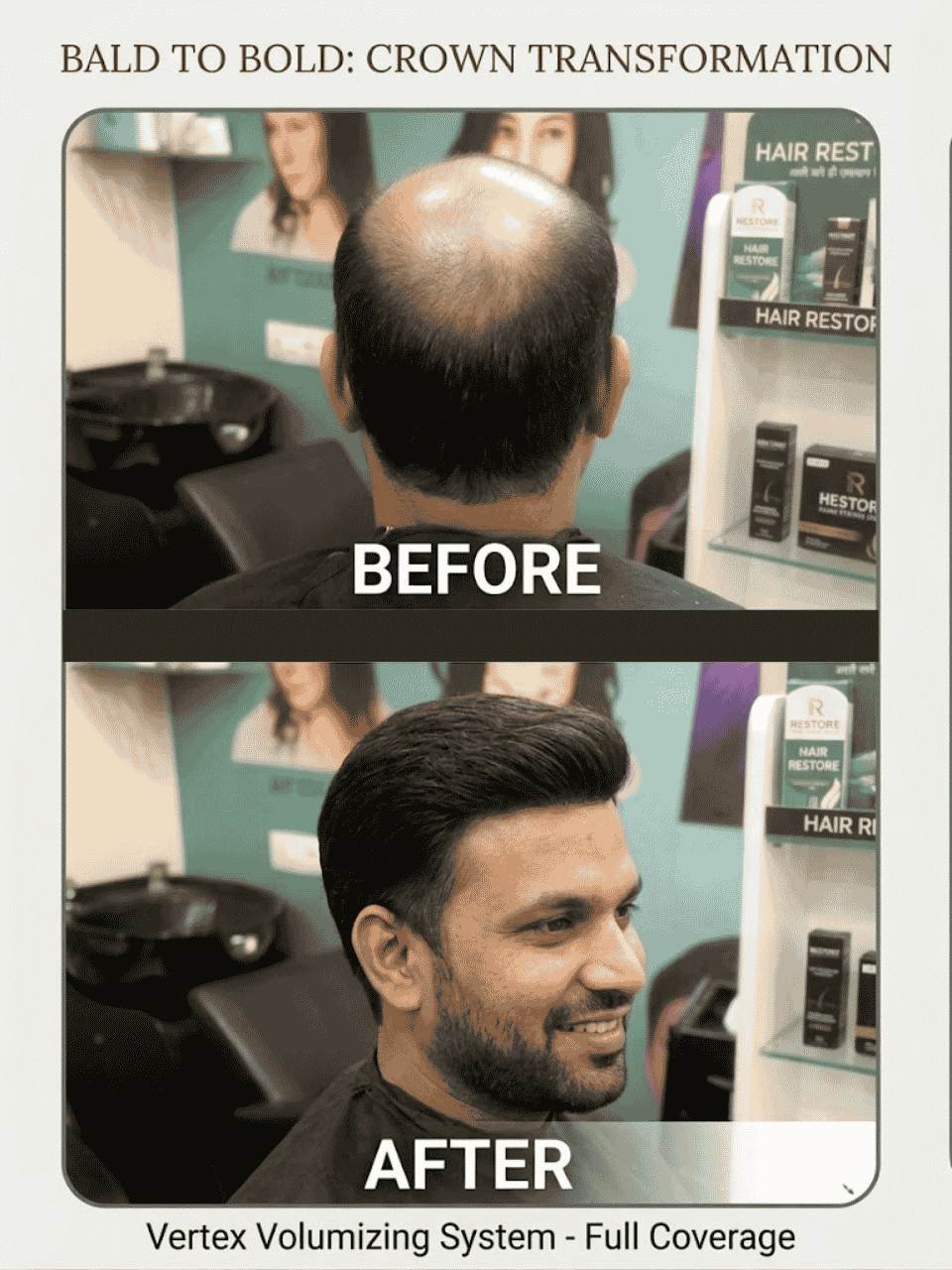 asansol hair wig before after (5)
