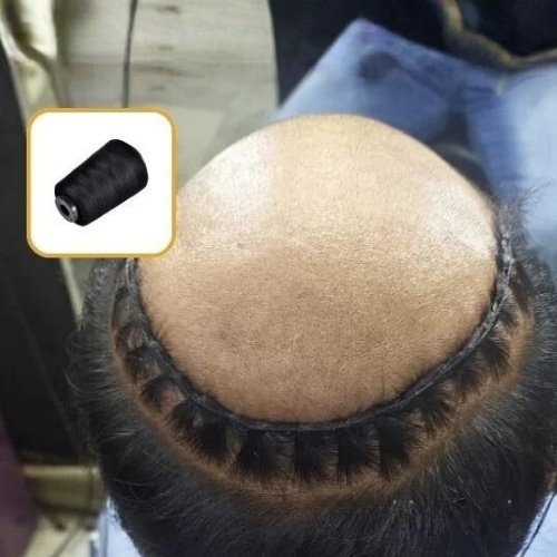 hair wig Asansol