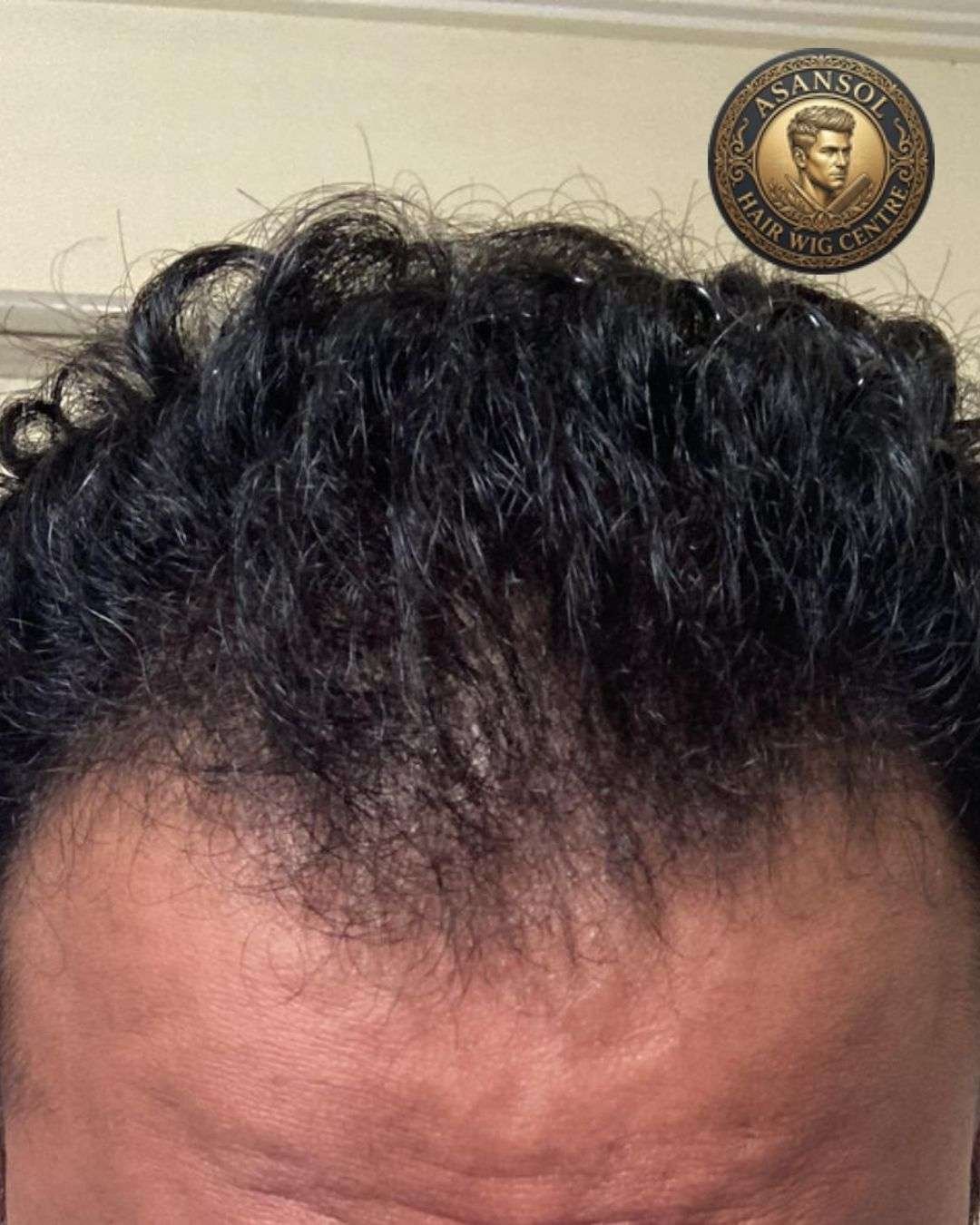 hair-wig-for-men-in-asansol-01 - hair-wig-for-men-in-asansol-09-