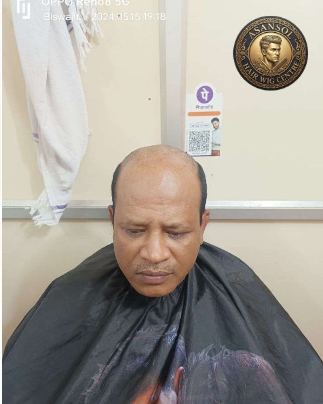 hair-wig-for-men-in-asansol-01 - hair-wig-for-men-in-asansol-20-