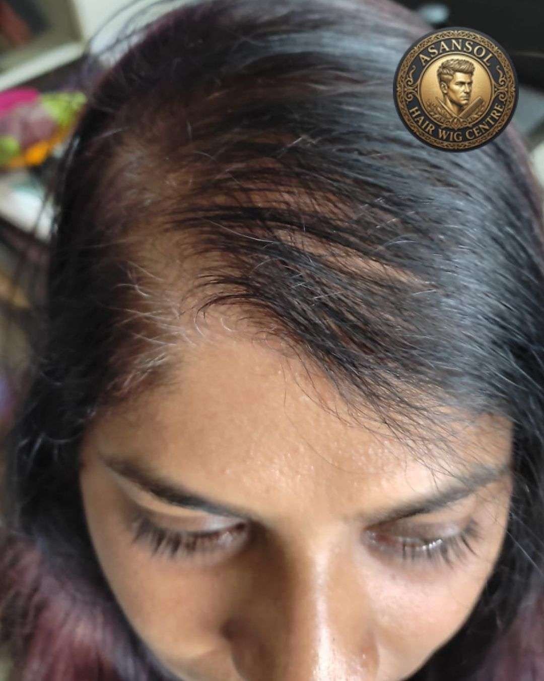 hair-wig-for-men-in-asansol-01 - hair-wig-for-men-in-asansol-25-