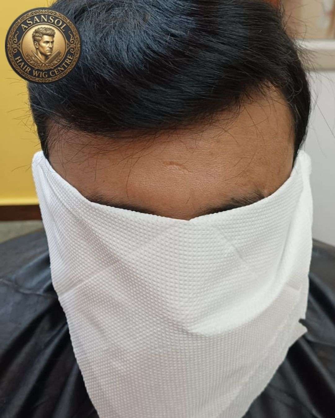 hair-wig-for-men-in-asansol-01 - hair-wig-for-men-in-asansol-36-
