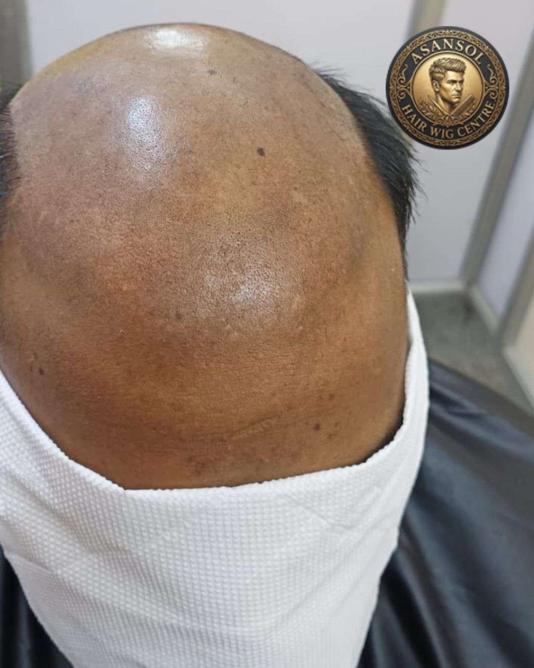 hair-wig-for-men-in-asansol-01 - hair-wig-for-men-in-asansol-37-