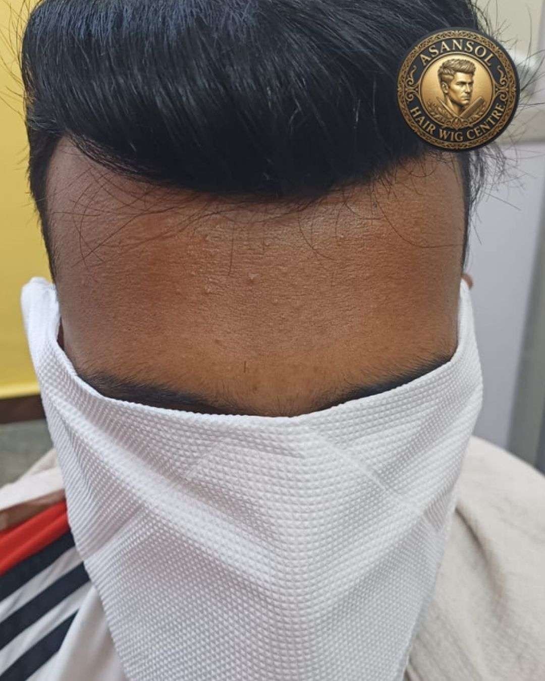 hair-wig-for-men-in-asansol-01 - hair-wig-for-men-in-asansol-38-