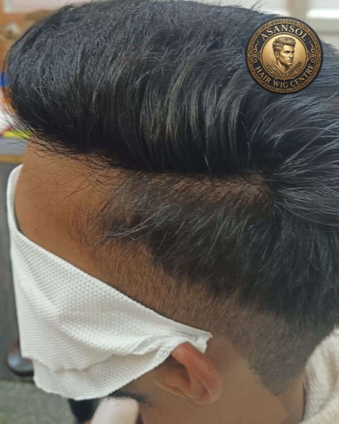 hair-wig-for-men-in-asansol-01 - hair-wig-for-men-in-asansol-40-
